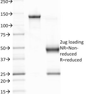 SDS-PAGE Analysis of Purified EBV Mouse Monoclonal Antibody (CS1).Confirmation of Integrity and Purity of Antibody.
