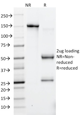 SDS-PAGE Analysis Purified HSV1 Mouse Monoclonal Antibody (10A3).