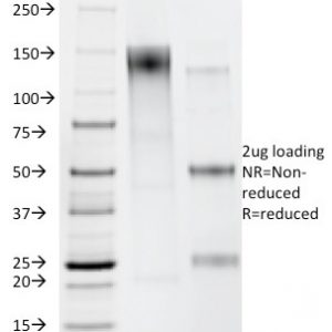 SDS-PAGE Analysis of Purified Helicobacter pylori Mouse Monoclonal Antibody (HP/212). Confirmation of Purity and Integrity of Antibody.