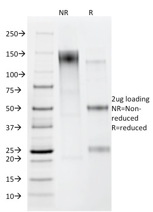 SDS-PAGE Analysis Purified Helicobacter pylori Mouse Monoclonal Antibody (HP/212). Confirmation of Purity and Integrity of Antibody.