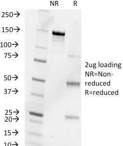 SDS-PAGE Analysis of Purified Progesterone Mouse Monoclonal Antibody (6-5E-10B). Confirmation of Purity and Integrity of Antibody.