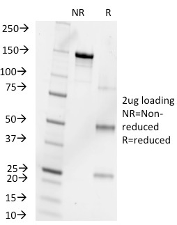 SDS-PAGE Analysis Purified Progesterone Mouse Monoclonal Antibody (6-5E-10B). Confirmation of Purity and Integrity of Antibody.