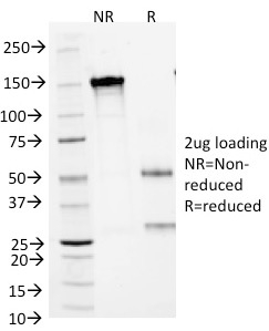 SDS-PAGE Analysis Purified SCLC Mouse Monoclonal Antibody (MOC-52). Confirmation of Purity and Integrity of Antibody.