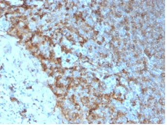 Formalin-fixed, paraffin-embedded human tonsil stained with HLA-Pan Mouse Recombinant Monoclonal Antibody (rHLA-Pan/3475).