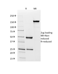 SDS-PAGE Analysis Purified HLA-Pan Mouse Recombinant Monoclonal (rHLA-Pan/3475). Confirmation of Purity and Integrity of Antibody.