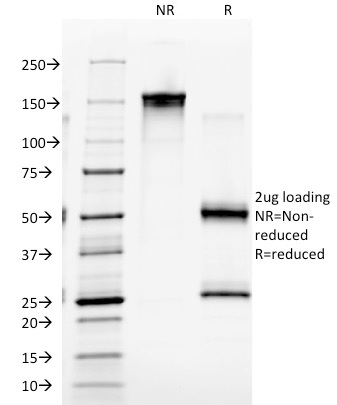 SDS-PAGE Analysis Purified Macrophage Monoclonal Antibody (D11). Confirmation of Purity and Integrity of Antibody.