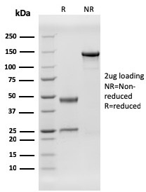 SDS-PAGE Analysis Purified HHV8 Recombinant Mouse Monoclonal Antibody (HHV8/3606). Confirmation of Purity and Integrity of Antibody.