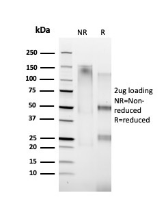 SDS-PAGE Analysis of Purified Cyclin A Mouse Monoclonal Antibody (XLA1-1). Confirmation of Purity and Integrity of Antibody.