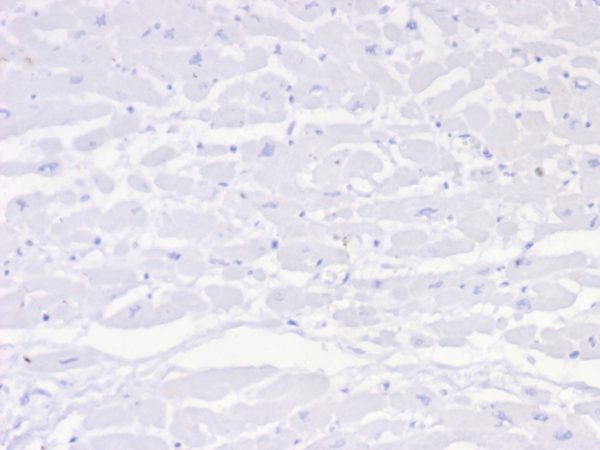 Formalin-fixed, paraffin-embedded human heart stained with Negative Control for Mouse Monoclonal Antibody (IGG1/453). HIER: Tris/EDTA, pH9.0, 45min. 2 °: HRP-polymer, 30min. DAB, 5min.