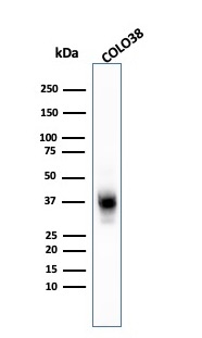 Western Blot Analysis of COLO-38 cell lysate using Melanoma Marker MAb (A103 + T311 + HMB45).