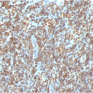 Formalin-fixed, paraffin-embedded human Tonsil stained with Double Stranded DNA Mouse Monoclonal Antibody (AE-2)