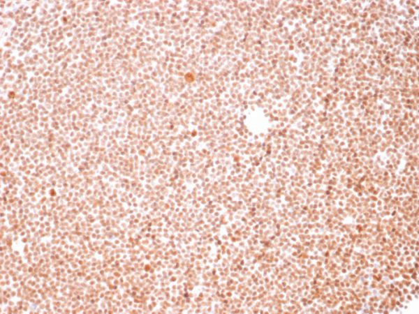 Formalin-fixed, paraffin-embedded human Tonsil stained with Nucleolar Mouse Monoclonal Antibody (NM95).