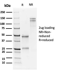 SDS-PAGE Analysis Purified Nucleolar Mouse Monoclonal Antibody (NM95). Confirmation of Purity and Integrity of Antibody