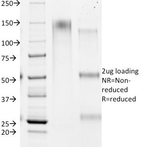 SDS-PAGE Analysis of Purified HSA Mouse Monoclonal Antibody (HSA98). Confirmation of Purity and Integrity of Antibody.