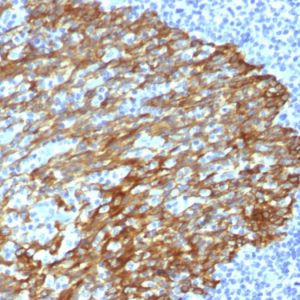 Formalin-fixed, paraffin-embedded human Tonsil stained with Cytokeratin, HMW Mouse Monoclonal Antibody (DE-SQ).