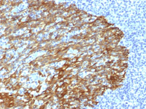 Formalin-fixed, paraffin-embedded human Tonsil stained with Cytokeratin, HMW Mouse Monoclonal Antibody (DE-SQ).