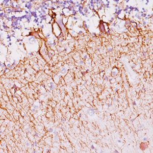 Formalin-fixed, paraffin-embedded human Cerebellum stained with Neurofilament Monoclonal Antibody (SPM145).