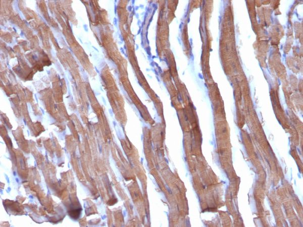 Formalin-fixed, paraffin-embedded Rat Heart stained with Muscle Specific Actin Monoclonal Antibody (HHF35 + MSA/953)