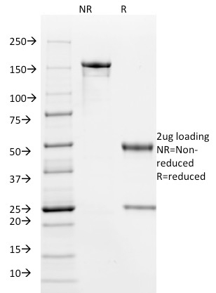 SDS-PAGE Analysis Purified HPV-16 Mouse Monoclonal Antibody (HPV16/1295). Confirmation of Purity and Integrity of Antibody.