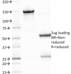 SDS-PAGE Analysis of Purified EBV Mouse Monoclonal Antibody (CS2). Confirmation of Integrity and Purity of Antibody.