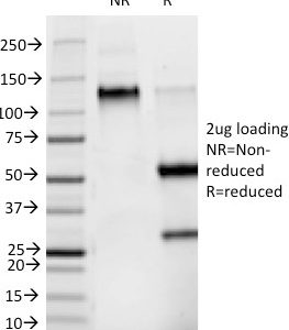 SDS-PAGE Analysis of Purified Phosphotyrosine Mouse Monoclonal Antibody (PY265). Confirmation of Purity and Integrity of Antibody.