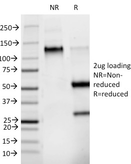 SDS-PAGE Analysis Purified Phosphotyrosine Mouse Monoclonal Antibody (PY265). Confirmation of Purity and Integrity of Antibody.