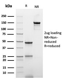 SDS-PAGE Analysis Purified Anti-Hexa-histidine Recombinant Mouse Monoclonal r6HIS/6423). Confirmation of Integrity and Purity of Antibody.