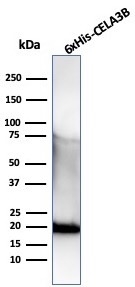 Western blot analysis of recombinant His-Tag protein using Anti-Hexa-histidine Recombinant Mouse Monoclonal r6HIS/6423).