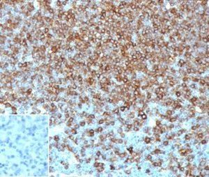 Formalin-fixed, paraffin-embedded human lymph node stained with HLA-Pan Mouse Monoclonal Antibody (HLA-Pan/6663). Inset: PBS instead of primary, secondary negative control.