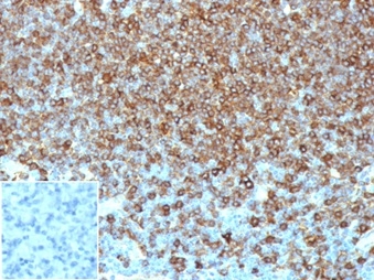 Formalin-fixed, paraffin-embedded human lymph node stained with HLA-Pan Mouse Monoclonal Antibody (HLA-Pan/6663). Inset: PBS instead of primary, secondary negative control.