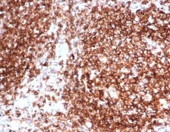 Formalin-fixed, paraffin-embedded human tonsil stained with HLA-Pan Mouse Monoclonal Antibody (HLA-Pan/6663).
