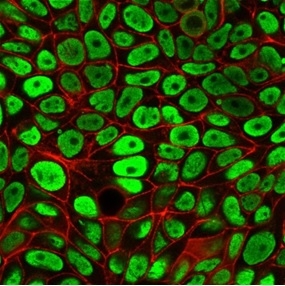 Immunofluorescent staining of PFA-fixed MCF-7 cells with Human Nuclear Antigen Mouse Monoclonal Antibody (235-1) followed by goat anti-mouse IgG-CF488 (green). Counterstained with phalloidin.
