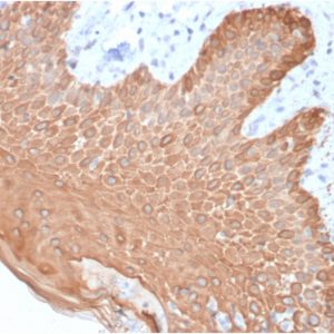 Formalin-fixed, paraffin-embedded human Skin stained with Multi-Cytokeratin Mouse Recombinant Monoclonal Antibody (rKRT/457).