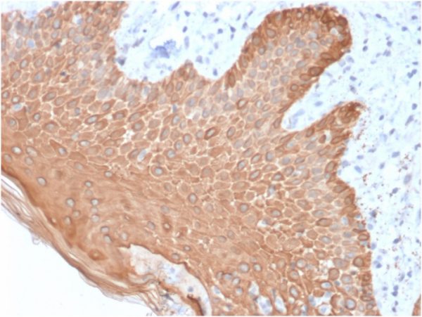 Formalin-fixed, paraffin-embedded human Skin stained with Multi-Cytokeratin Mouse Recombinant Monoclonal Antibody (rKRT/457).
