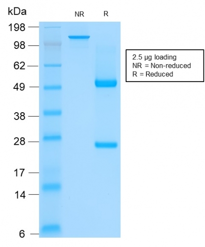 SDS-PAGE Analysis of Purified CK HMW Mouse Recombinant Monoclonal Antibody (rKRTH/2148). Confirmation of Integrity and Purity of Antibody.