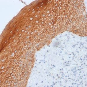 Formalin-fixed, paraffin-embedded human Skin stained with Cytokeratin, 5/6/18 Mouse Monoclonal Antibody (LP34).