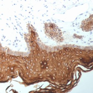 Formalin-fixed, paraffin-embedded human Skin stained with Cytokeratin, 5/6/18 Mouse Monoclonal Antibody (SPM267).