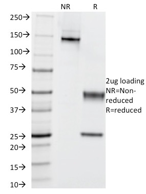 SDS-PAGE Analysis Purified Cytokeratin 5/6 Mouse Monoclonal Antibody (KRT5.6/2438). Confirmation of Integrity and Purity of Antibody.
