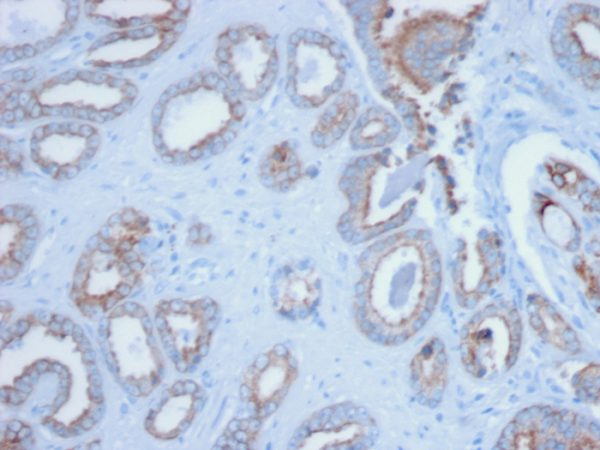 Formalin-fixed, paraffin-embedded human Prostate stained with Pan-Cytokeratin Mouse Monoclonal Antibody (PCK/3150).