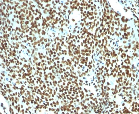 Formalin-fixed, paraffin-embeddedhuman tonsil stained with Pan-Nuclear AntigenMonoclonal Antibody (NM106).