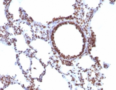 Formalin-fixed, paraffin-embeddedratlung stained with Pan-Nuclear AntigenMonoclonal Antibody (NM106).
