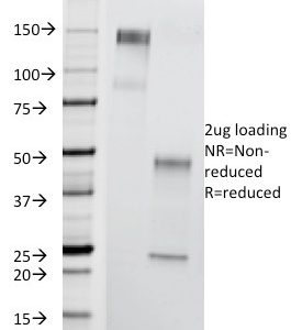 SDS-PAGE Analysis of Purified T-F Antigen Mouse Monoclonal Antibody (A84-A/F10). Confirmation of Purity and Integrity of Antibody.