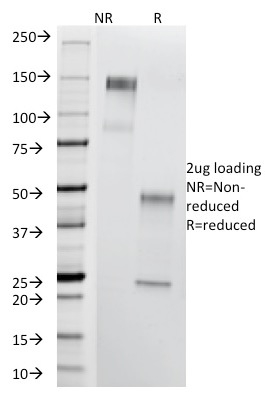 SDS-PAGE Analysis Purified T-F Antigen Mouse Monoclonal Antibody (A84-A/F10). Confirmation of Purity and Integrity of Antibody.