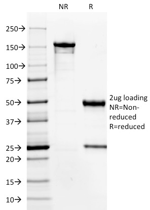 SDS-PAGE Analysis Purified HPV-16 Mouse Monoclonal Antibody (HPV16/1296). Confirmation of Purity and Integrity of Antibody