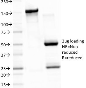 SDS-PAGE Analysis of Purified EBV Mouse Monoclonal Antibody (CS3). Confirmation of Integrity and Purity of Antibody.