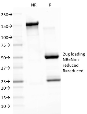 SDS-PAGE Analysis Purified EBV Mouse Monoclonal Antibody (CS3). Confirmation of Integrity and Purity of Antibody.