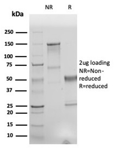 SDS-PAGE Analysis Purified HNA Recombinant Mouse Monoclonal Antibody (r235-1). Confirmation of Purity and Integrity of Antibody.