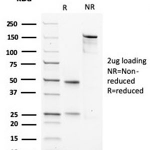 SDS-PAGE Analysis Purified MSA Recombinant Mouse Monoclonal Antibody (rMSA/953). Confirmation of Purity and Integrity of Antibody.