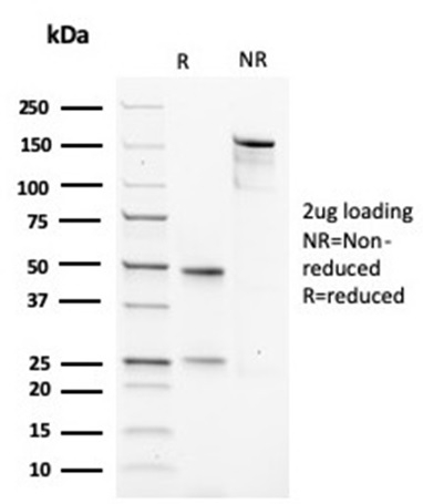 SDS-PAGE Analysis Purified MSA Recombinant Mouse Monoclonal Antibody (rMSA/953). Confirmation of Purity and Integrity of Antibody.