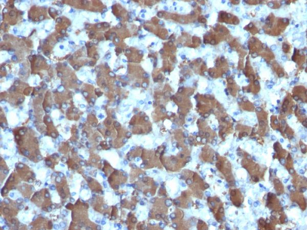 Formalin-fixed, paraffin-embedded human Liver stained with HepPar-1 Mouse Monoclonal Antibody (HepPar1).